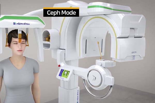 CBCT là công nghệ Nha khoa đang được ứng dụng rộng rãi trên thế giới