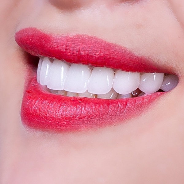 Lựa chọn một địa chỉ bọc răng sứ uy tín sẽ giúp bạn có được hàm răng đều đẹp như mơ