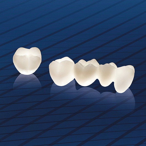Răng sứ ceramill là dòng răng sứ được ưa chuộng nhất hiện nay