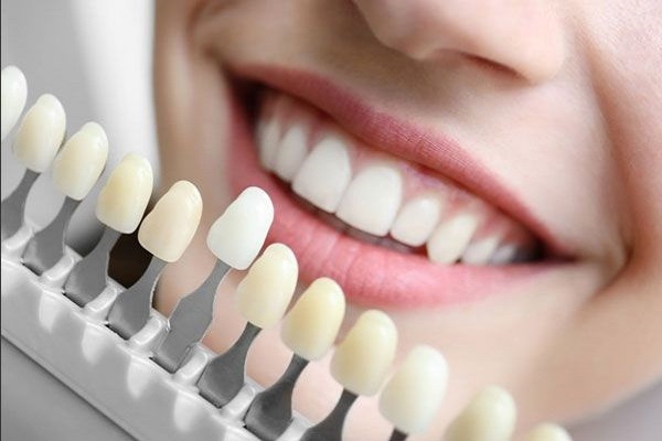 Giá thành bọc răng sứ ceramill thường khá cao