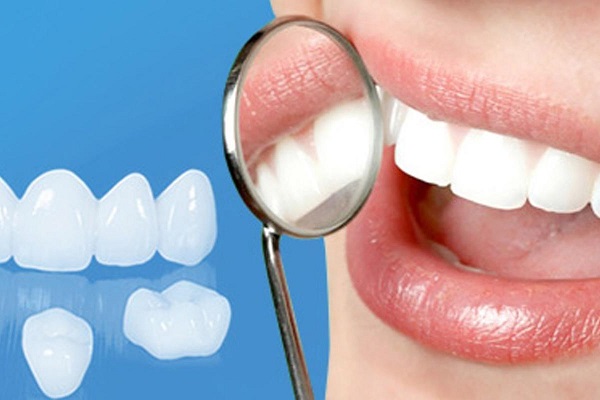 Bọc răng sứ độ bền bao lâu còn tùy thuộc vào chất liệu răng sứ