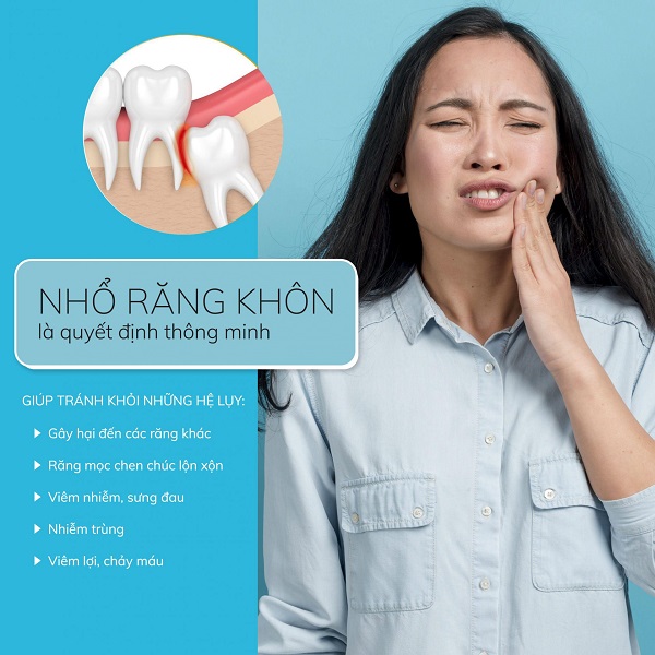 Răng khôn thường gây đau nhức, khó chịu