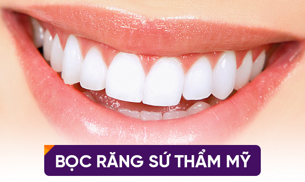 Bọc răng sứ là xu hướng thẩm mỹ được tin chọn hiện nay