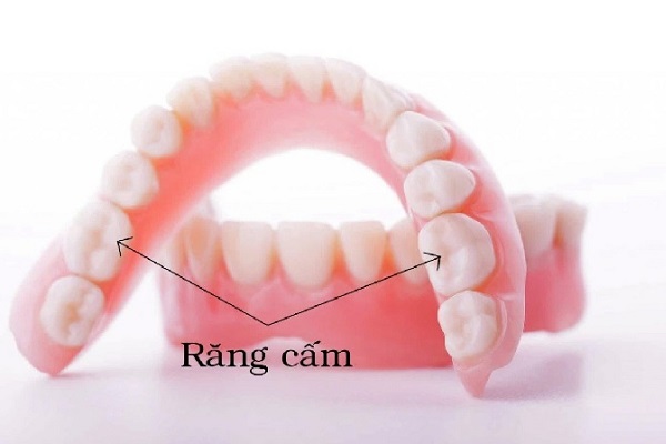 Hãy chăm sóc răng số 6 thật kỹ càng bạn nhé!