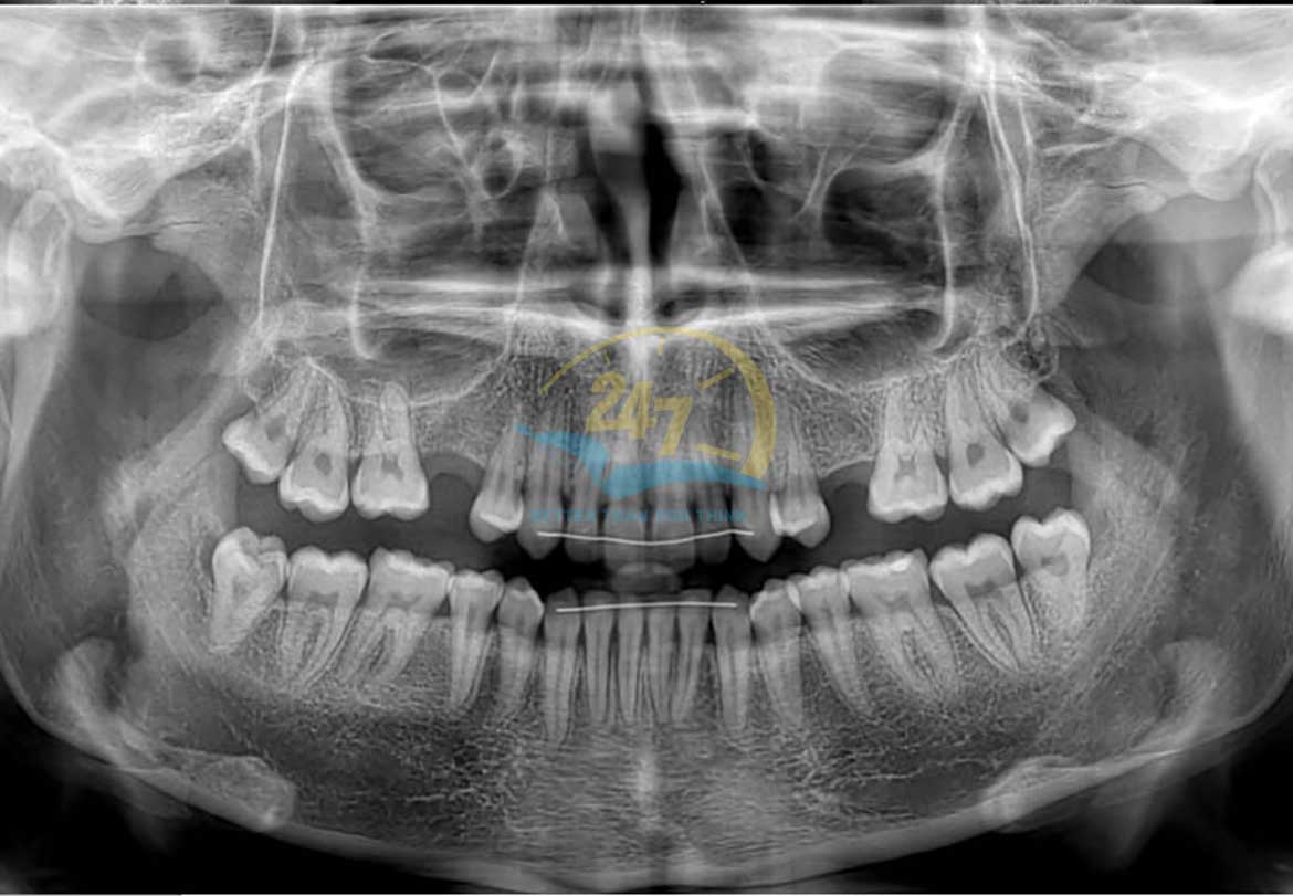 Chụp X-quang 3D-thumb