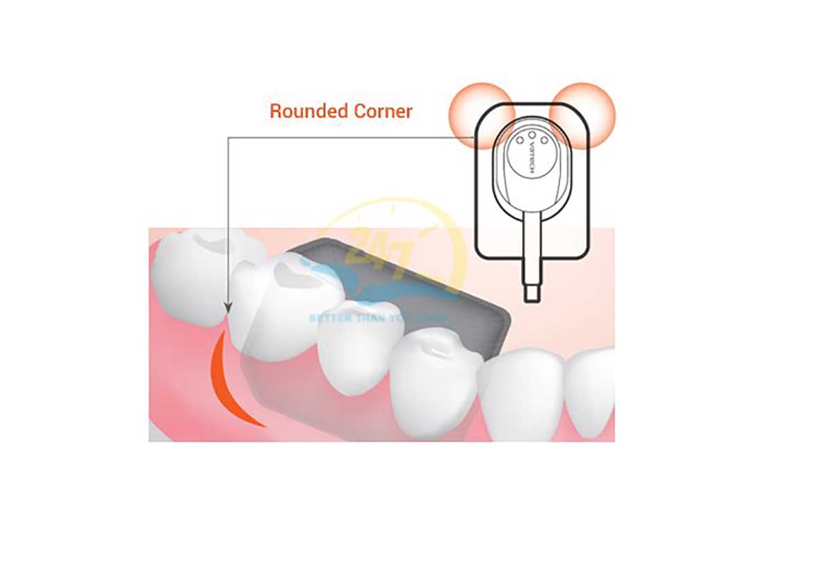 Sensor-cao-cap-trong-nha-khoa-thumb