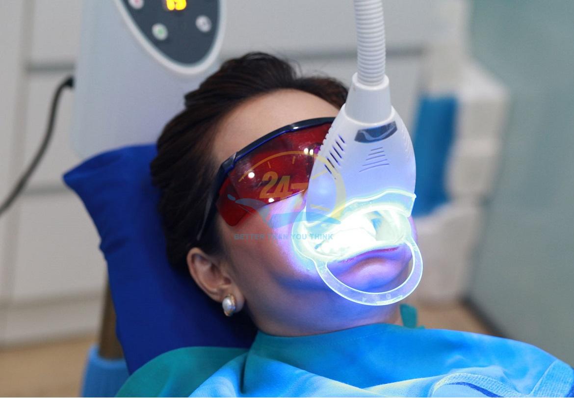 Ứng dụng đèn tẩy trắng răng vào thực tiễn điều trị sẽ giúp đẩy nhanh hiệu quả làm trắng, sáng răng mà không gây xâm lấn, ê buốt