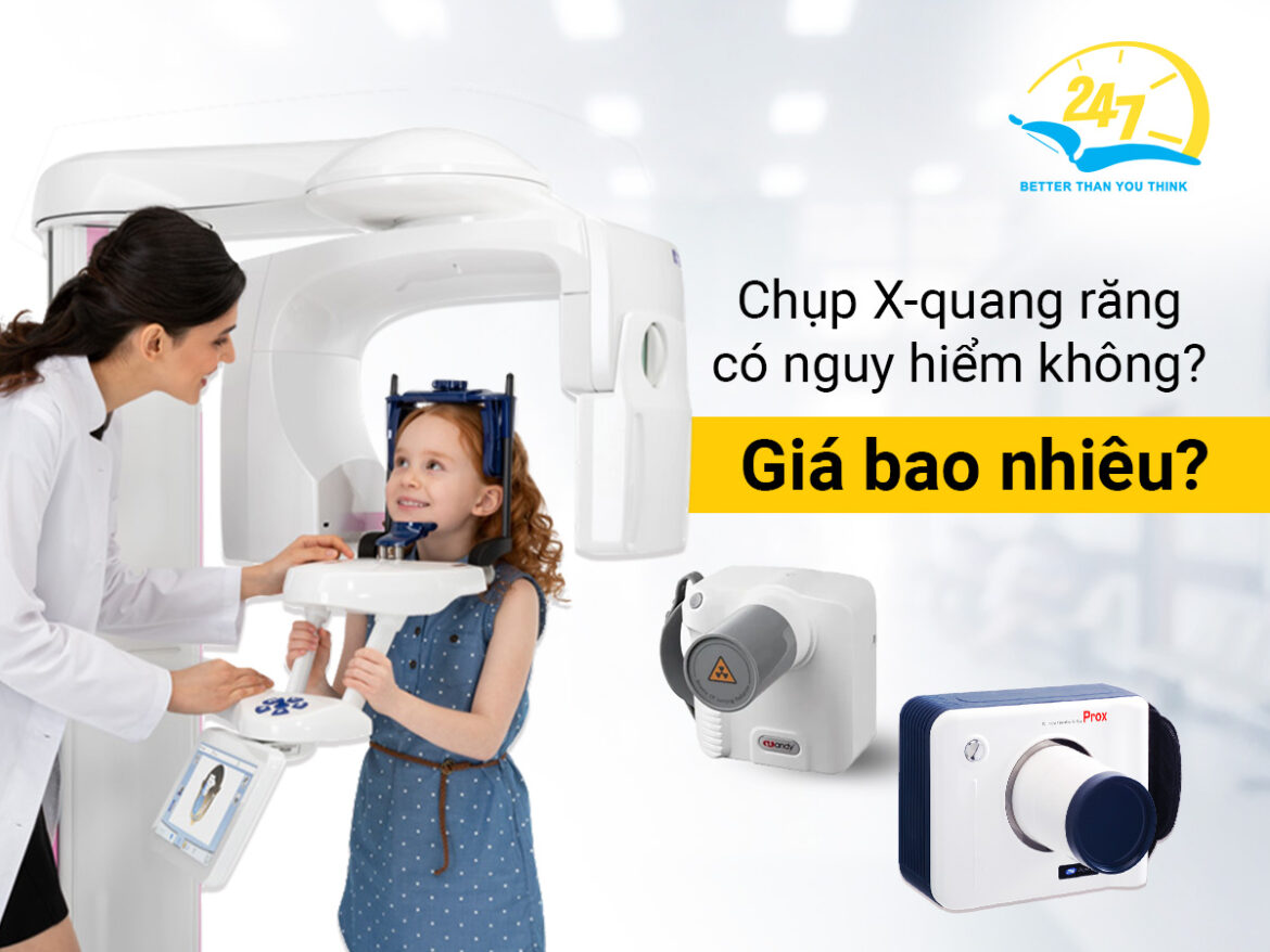 Chụp x-quang răng có nguy hiểm không? Giá bao nhiêu?