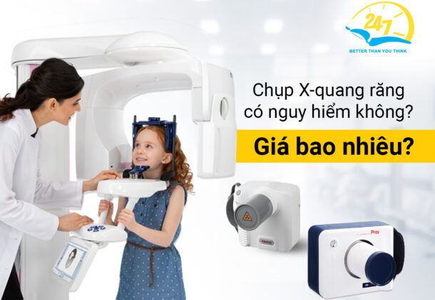 Chụp x-quang răng có nguy hiểm không? Giá bao nhiêu?