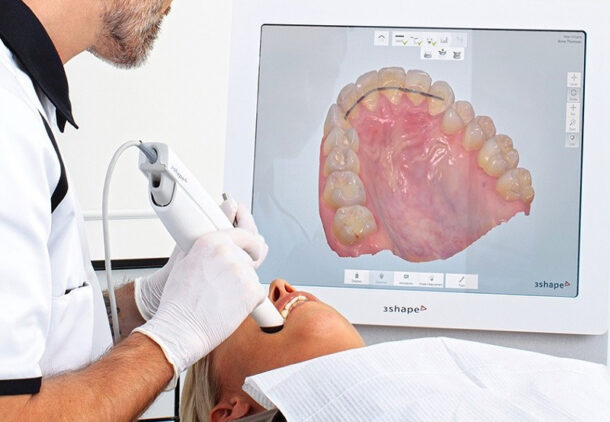 Máy scan trong miệng: lợi ích, công nghệ và cách lựa chọn tốt nhất