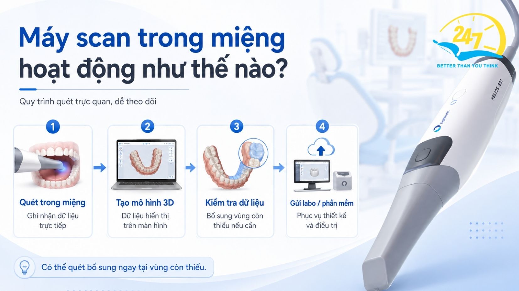 Máy scan trong miệng hoạt động như thế nào